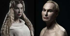 Fotógrafo registra o resultado do excesso de cirurgias plásticas