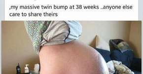 Por fetiche, homens fingem gravidez para se aproximar de gestantes