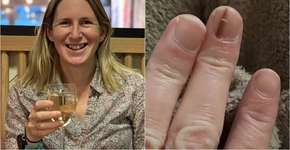 Foto: (reprodução/Facebook/Elizabeth Misselbrook)