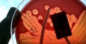 Foto: (Scharvik/istock)