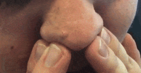 Impressionante! Jovem espreme vários cravos de uma só vez