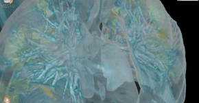 Foto: (Divulgação/GWUH)