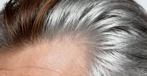 Foto: (Imagem sem texto alternativo disponivel ID [2668670])