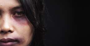 Foto: (Imagem sem texto alternativo disponivel ID [752780])