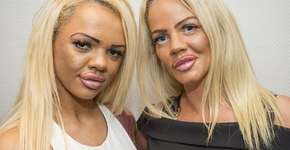 Mãe e filha viciadas em cirurgias plásticas ganham reality show na TV britânica