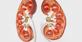 Fator na alimentação que está ligado à formação de pedras nos rins