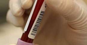 Tipo sanguíneo pode aumentar chance de ter Alzheimer, diz estudo