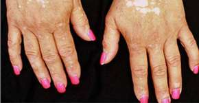 Foto: (Imagem sem texto alternativo disponivel ID [1833290])