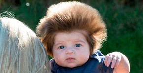 Lembra dele? Veja como está o bebê cabeludo fofo da web