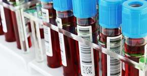 Foto: (Imagem sem texto alternativo disponivel ID [1621094])