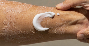 Foto: (Imagem sem texto alternativo disponivel ID [2724064])