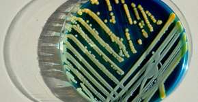 Foto: (Scharvik/istock)