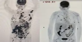 Foto: (reprodução/TV)