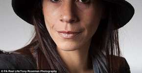 Mulher com câncer de mama abdica quimioterapia e tenta cura alternativa