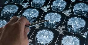 Foto: (Getty Images)