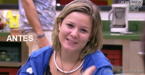 Ex BBB Cacau mostra resultados do preenchimento labial e do botox