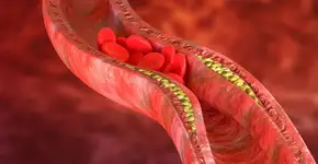 Harvard lista alimentos que ajudam a reduzir o colesterol LDL