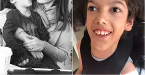 Ele me fez ver as diferenças, diz mãe de menino com síndrome rara