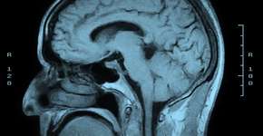 Foto: (CGinspiration/istock)