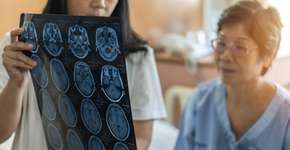 Mulheres com esta condição têm maior risco de ter AVC