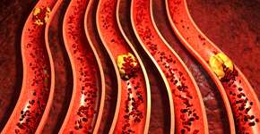 Foto: (Depositphotos/ralwel)