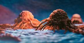 Foto: (iStock/koto_feja)