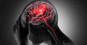 Uma em cada quatro pessoas pode sofrer um AVC, mas 90% dos casos são evitáveis