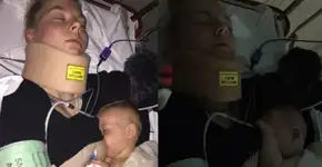 Mãe se acidenta e recusa analgésicos para não parar amamentação