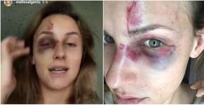 Brasileiro acusado de espancar namorada é preso nos EUA