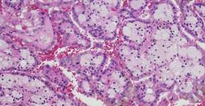 Foto: (iStock/OGphoto)