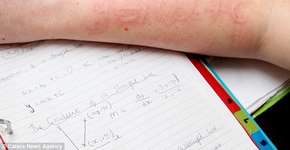 Foto: (© Caters News Agency)