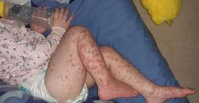 Foto: (reprodução/Facebook)