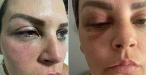 Empresária acusa advogado de agredi-la por causa de um colete salva-vidas