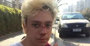 Foto: (Imagem sem texto alternativo disponivel ID [1496250])