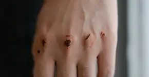 5 sinais na pele podem indicar doença grave