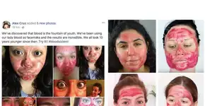 Máscara facial com sangue menstrual: entenda essa vibe