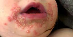 Foto: (reprodução/Instagram/cprkids)