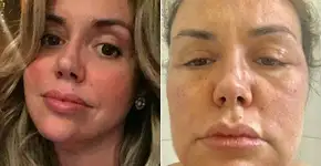 Renata Banhara sobre tratamento alternativo: ‘Deu tudo errado’