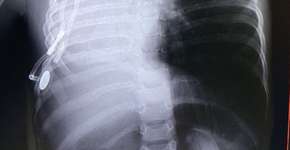 Foto: (triangle news)