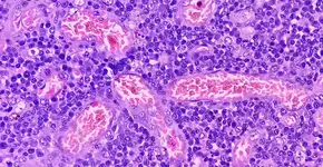 O que comer para prevenir o câncer? Conheça 3 alimentos