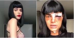 Alice Felis, modelo trans espancada em seu apartamento no Rio: ‘Transfobia mata’