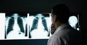 Foto: (diego_cervo/DepositPhotos)