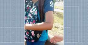 Foto: (Imagem sem texto alternativo disponivel ID [1863014])