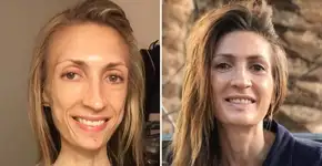 Mulher que quase morreu por não comer mostra incrível recuperação