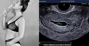 Li Martins, do Rouge, sofre aborto espontâneo e desabafa na web