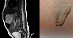 Foto: (reprodução/Journal of Pediatric Surgery Case Reports)