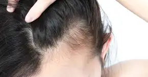 Foto: (iStock/Mintra Kwthijak)