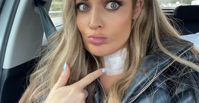 Câncer de tireoide é confundido com resfriado; veja sintomas