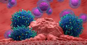 Pesquisadores alertam para algo comum que pode desencadear câncer