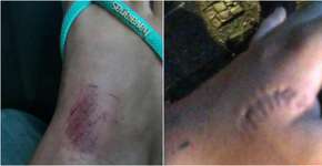 Mãe e filha são espancadas ao tentar defender cachorro